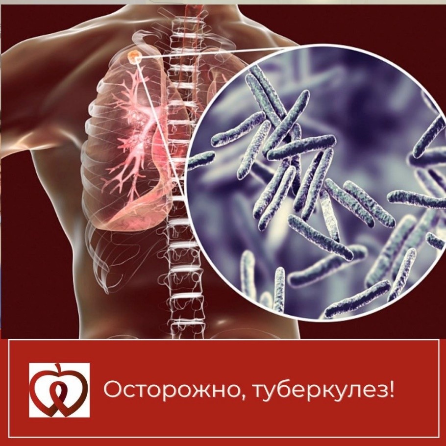 Туберкулез легких: причины появления, симптомы, диагностика и способы лечения